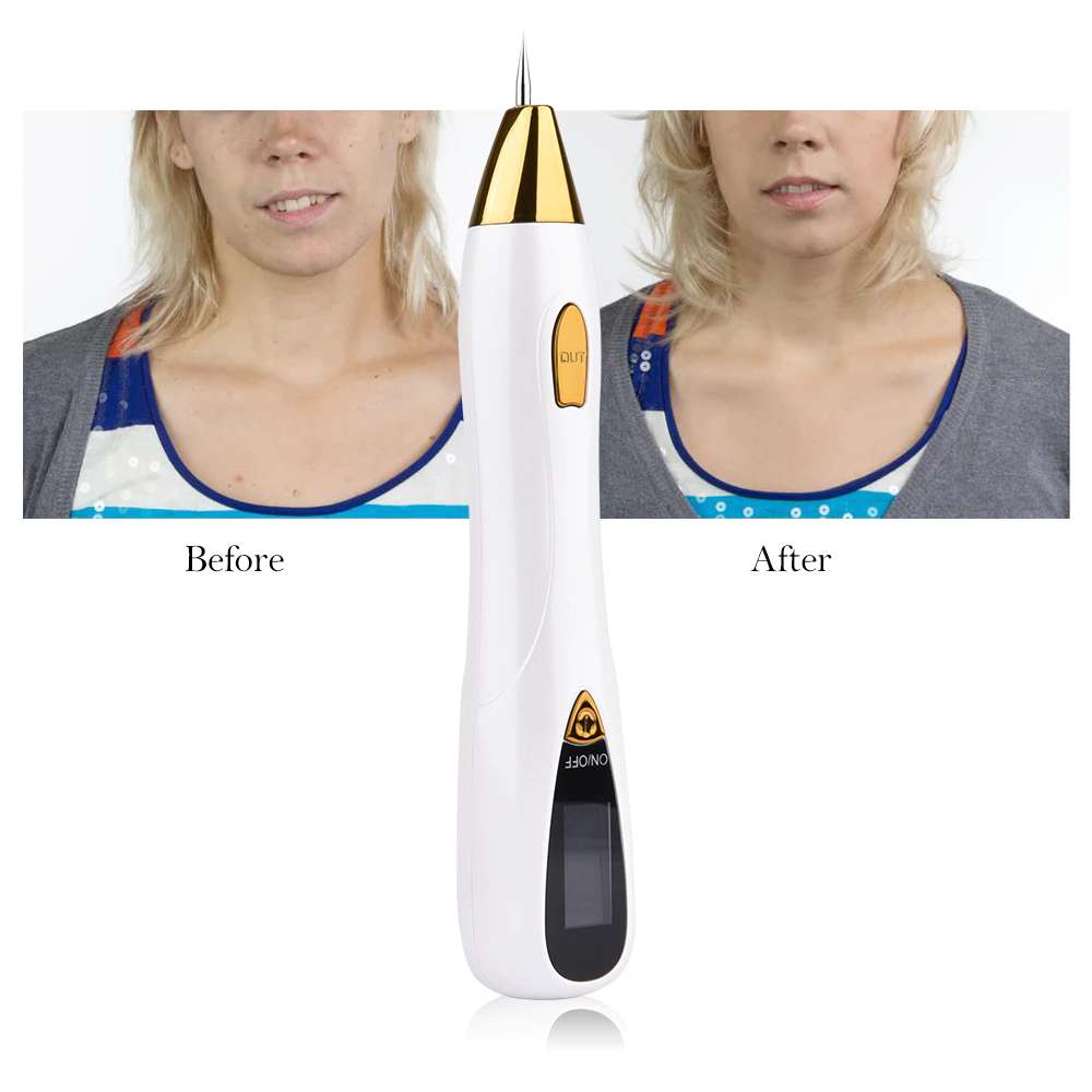 Up To 85% Off on Electric LCD Laser Mole Freck